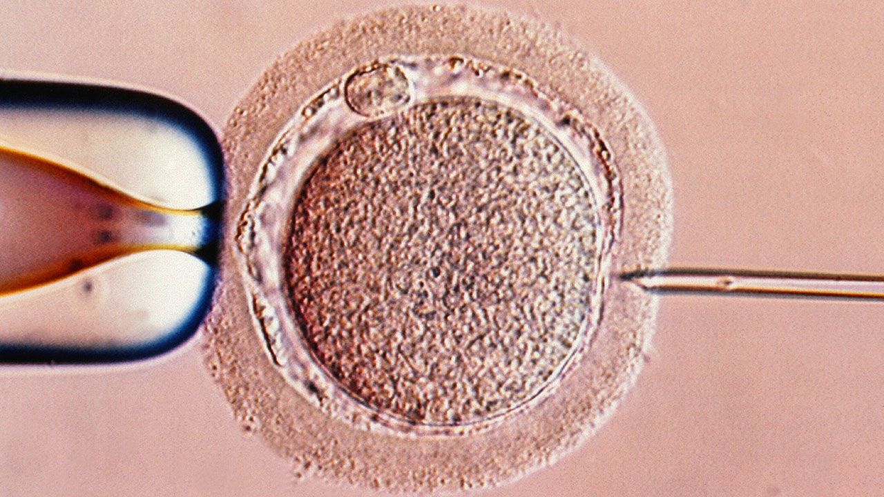 Intracytoplasmic sperm injection, Light microscope.
