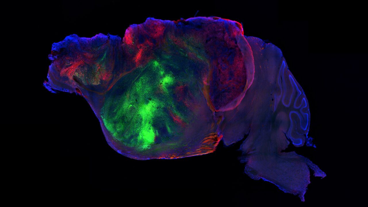 Side view of a xenocortical mouse brain showing nerve fibers extending from the human graft (colored with green and red fluorescent proteins) through the mouse brain (blue).