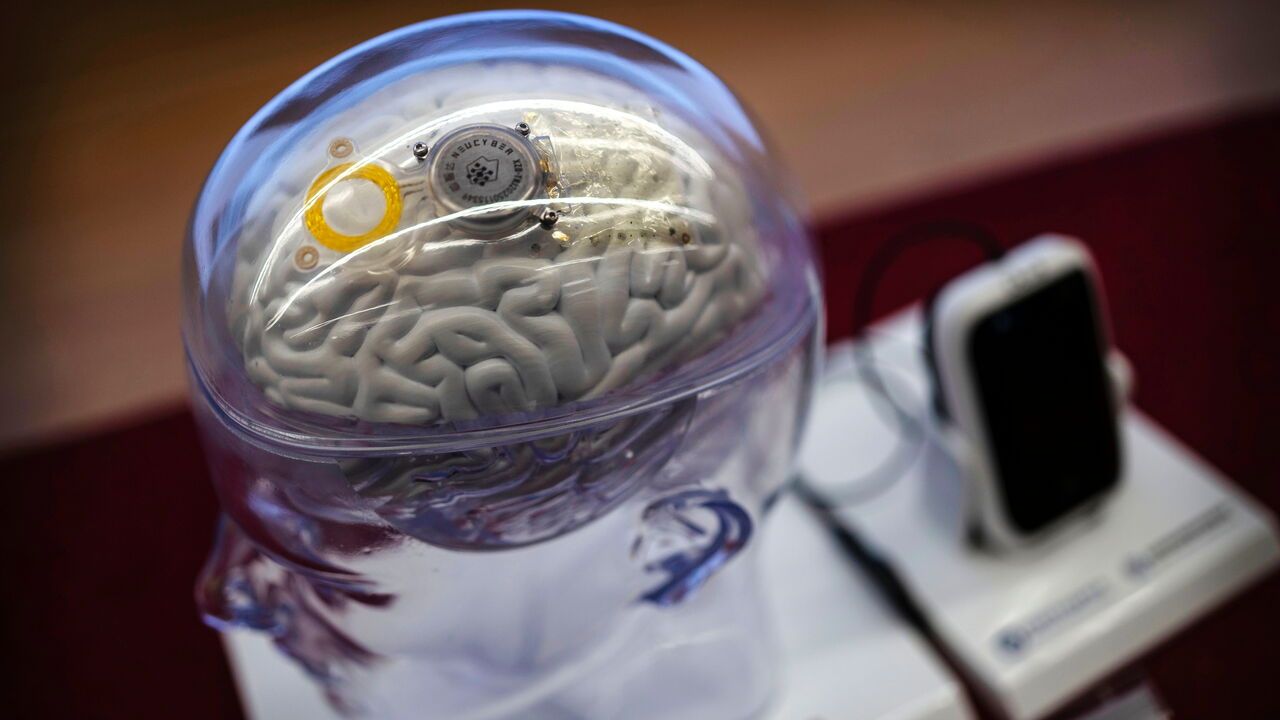 The Beinao-1, a semi-invasive brain-computer interface system, is displayed during a press conference at the Chinese Institute for Brain Research
